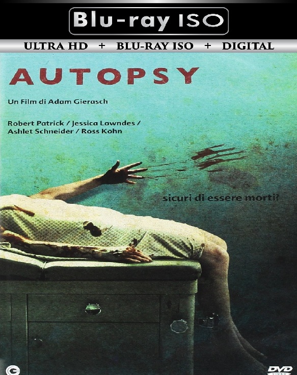 Autopsy